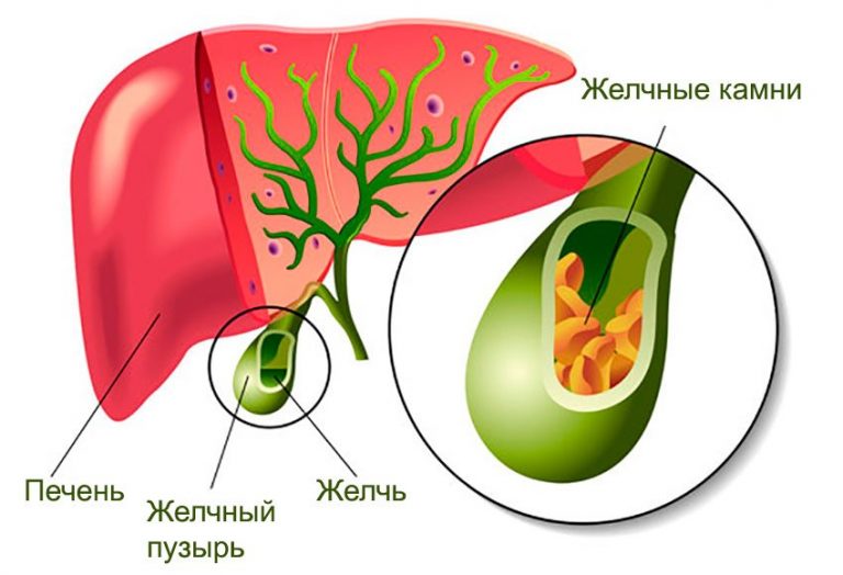 Желчный пузырь и зеленый стул